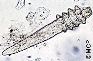 Demodex spp. Picture from M. Campos Pereira