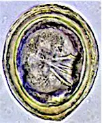 Huevo de Choanotaenia infundibulum. Imagen tomada de www.rvc.ac.uk 