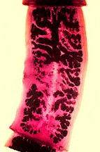 Segmento de un adulto de Taenia solium, la solitaria humana. Imagen tomada de Wikipedia commons