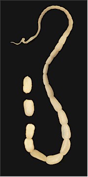 The dog tapeworm. Picture from Wikipedia Commons