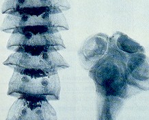 Segments (proglottids, left) and head (scolex, right) of Stilesia hepatica. © J. Kaufmann / Birkhäuser Verlag