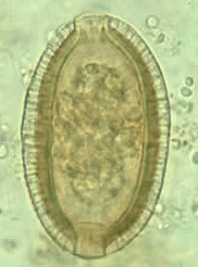 Egg of Capillaria philippinensis. Picture from www.dpd.cdc.gov