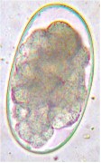 Huevo de Strongylus spp. Imagen tomada de www.loudoun.nvcc.edu