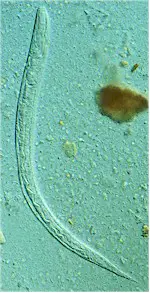 Larva de Strongyloides stercoralis. Imagen tomade de Wikipedia Commons.