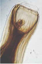 Cabeza de Strongylus vulgaris con cápsula bucal. Imagen tomada de wikipedia.commons