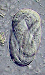 Egg of Strongyloides spp. Picture from www.wormbook.org