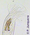 Trichostrongylus axei, male. Bursa copulatrix and spicules.
