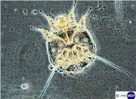 Scab mite (Sarcoptes scabiei). Picture from M. Campos Pereira