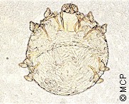 Ejemplar de Cnemidocoptes gallinae. Fotografía de M. Campos Pereira