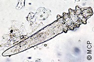 Ejemplar de Demodex canis. Fotografía de M. Campos Pereira