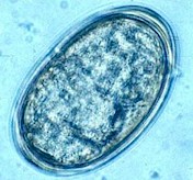 Huevo de Linguatula serrata. Imagen tomada de www2.vet-lyon.fr