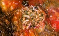 Wound with Wohlfahrtia magnifica maggots. Picture from bdm.typepad.com