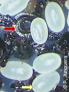 Eggs (yellow arrow) and feces (red arrow) of cat fleas (Ctenocephalides felis)