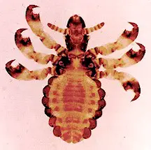 Haematopinus suis, adult. Picture from M. Campos Pereira 