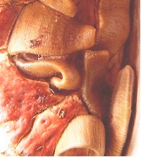 Adult Anaplocephala perfoliata in horse gut. Image from www.kfps.nl