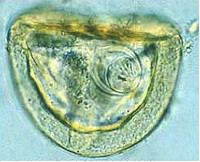 Huevo de Anoplocephala spp. Imagen tomada de www2.vetagro-sup.fr