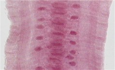 Segmentos de Avitellina centripunctata. Imagen tomada de iranhelminthparasites.com