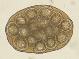 Cápsula con huevos de la tenia del perro. Fotografía tomada de Wikipedia Commons