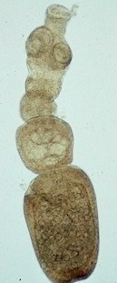 Adulto de Echnicoccus multilocularis. Imagen tomada de www.antropozoonosi.it