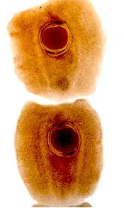 Segmentos de Mesocestoides lineatus expulsados en las heces de un zorro, cada uno con el característico órgano parauterino. Imagen tomada de izan.kiev.ua