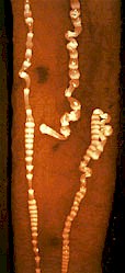 Raillietina spp en el intestino de un ave. Imagen tomada de www.eimeria.chez-alice.fr 