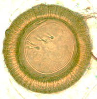 Huevo de Taenia spp. En el centro pueden observarse varios garfios. Imagen tomada de www.dpd.cdc.gov