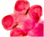 Head (scolex) of Thysanosoma actinioides. Picture from Lis Santos Marques in sites.google.com/site/parasitovet