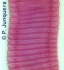 Segmentos (proglotis) típicos de un cestodo (Moniezia benedeni)