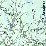 Grupo de nematodos gastrointestinales (Trichostrongylus axei)
