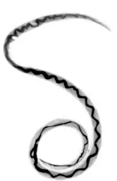 Hembra de Angiostrongylus cantonensis. Se oberva muy bien el intestino en espiral. Imagen tomada de Wikipedia Commons