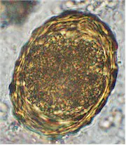 Huevo de Ascaris suum. Imagen de Wikipedia Commons.