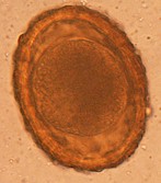Huevo de Bayliascaris procyonis. Imagen tomada de www.dpd.cdc.gov