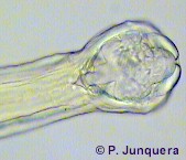 Mouth capsule of Bunostomum trigonocephalum