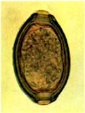 Huevo de Capillaria spp. Imagen tomada de www.eimeria.chez-alice.fr