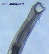 Mouth capsule of an adult Chabertia ovina.