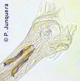 Bolsa copulatriz con espículas de un macho adulto de Cooperia curticei