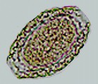 Huevo de Dioctophyma renale. Imagen tomada de www.naturalhealthtechniques.com