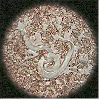 Heartworm microfilaria in blood under the microscope. Picture from Wikipedia Commons