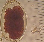 Huevo de Globocephalus urosubulatus. Imagen tomada de www.fiatlux.egloos.com