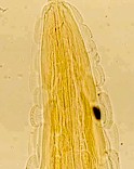 Anterior end of a Gongylonema adult, showing the typical cuticular platelets. Picture from www.gsaygi.4t.com