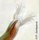 Haemonchus contortus male, copulatory bursa and spicules.