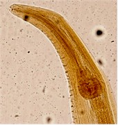 Cabeza de Heterakis gallinarum adulto. Imagen tomada de www.vet-parasitology.com