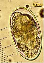 Huevo de Hyostrongylus rubidus. Imagen tomada de www.fiatlux.egloos.com