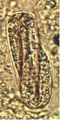 Huevo de Metastrongylus elongatus. Imagen tomada de www2.vetagro-sup.fr