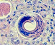 Thin section of a lung with Muellerius capillaris. © J. Kaufmann / Birkhäuser Verlag