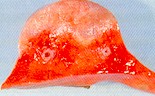 Lung nodule caused by Muellerius cpillaris. © J. Kaufmann / Birkhäuser Verlag