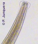 Extremo anterior de un macho adulto de Nematodirus spathiger. Puede verse bien la vesícula cefálica