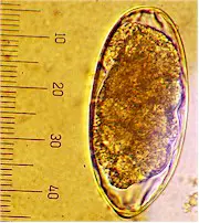 Egg of Oesophagostomum radiatum. Picture fom www.fiatlux.egloos.com
