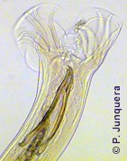 Teladorsagia circumcincta: copulatory bursa and spicules.