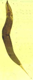 Oxyuris equi, gusano adulto. Imagen tomada de www.techniquesdelevage.fr